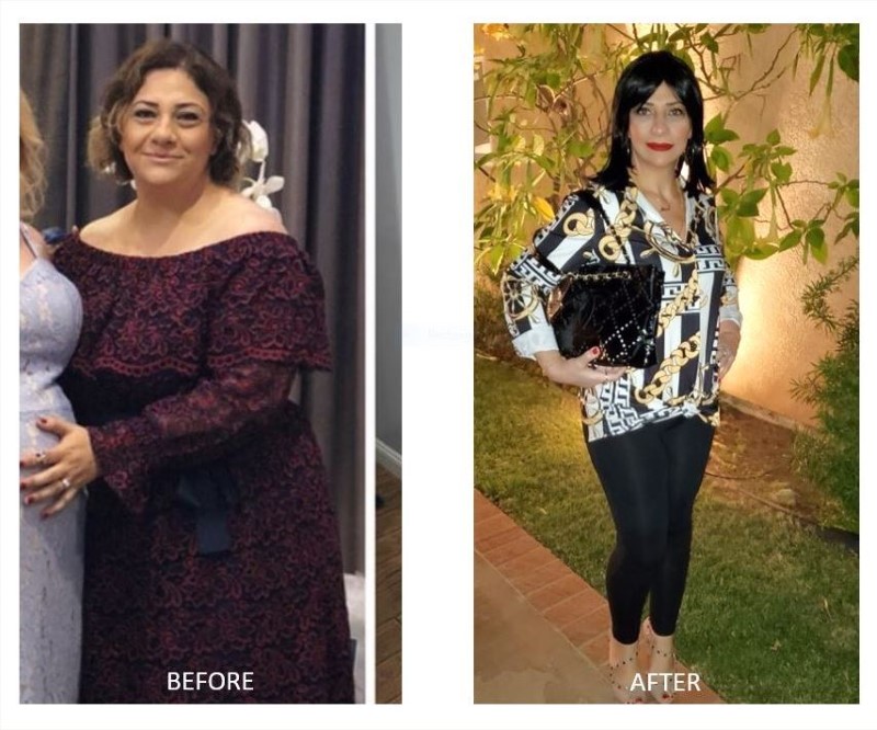 SOSE-CULVER-CITY-WEIGHT-LOSS-BARIATRICS.jpg